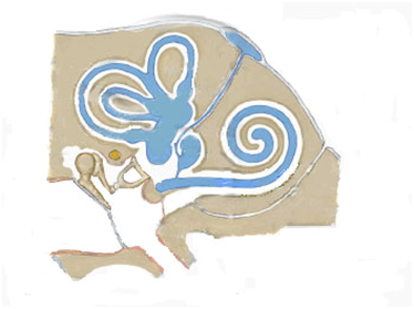 Mellemørebetændelse ses især hos små børn og er en helt almindelig sygdom