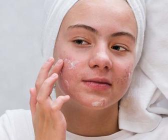 Ung pige smører creme på huden i ansigtet