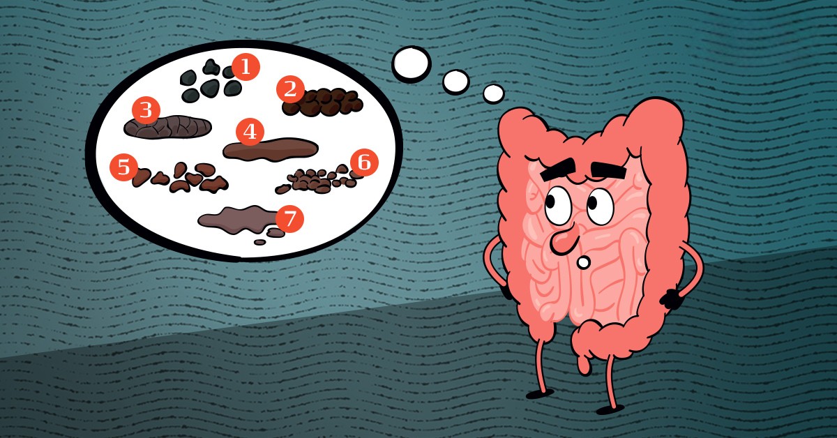 Illustration Typer Af Afføring.Jpg – Redigeret